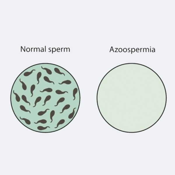 Green World Azoospermia Support Package – Male Fertility Supplements (1 Month)