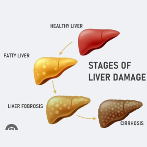 Green World Liver Wellness Support Supplement Package